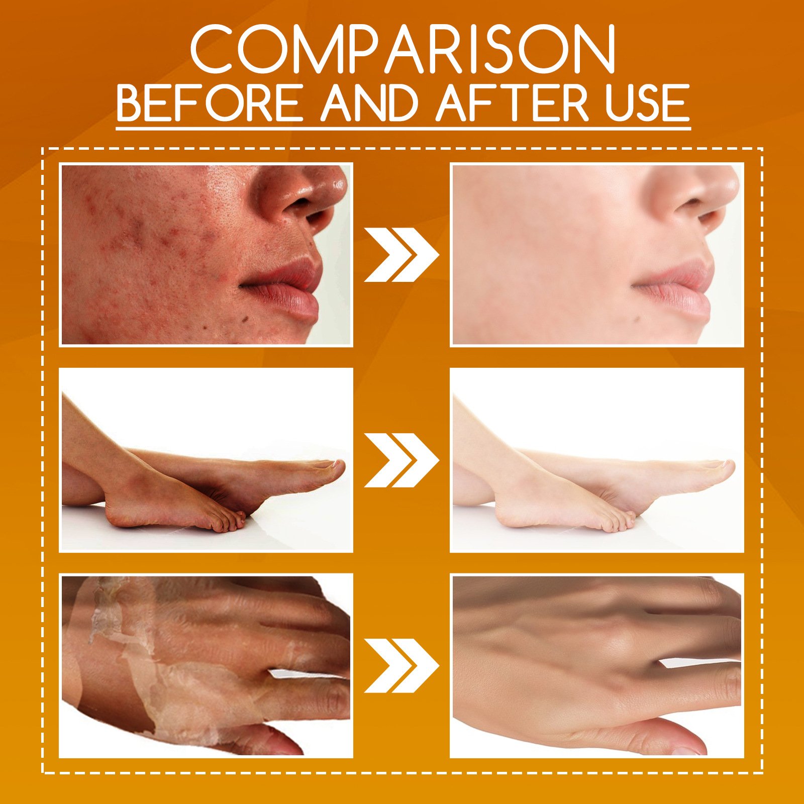 100ml Orange Peeling Loti... 100ml Orange Peeling Loti...