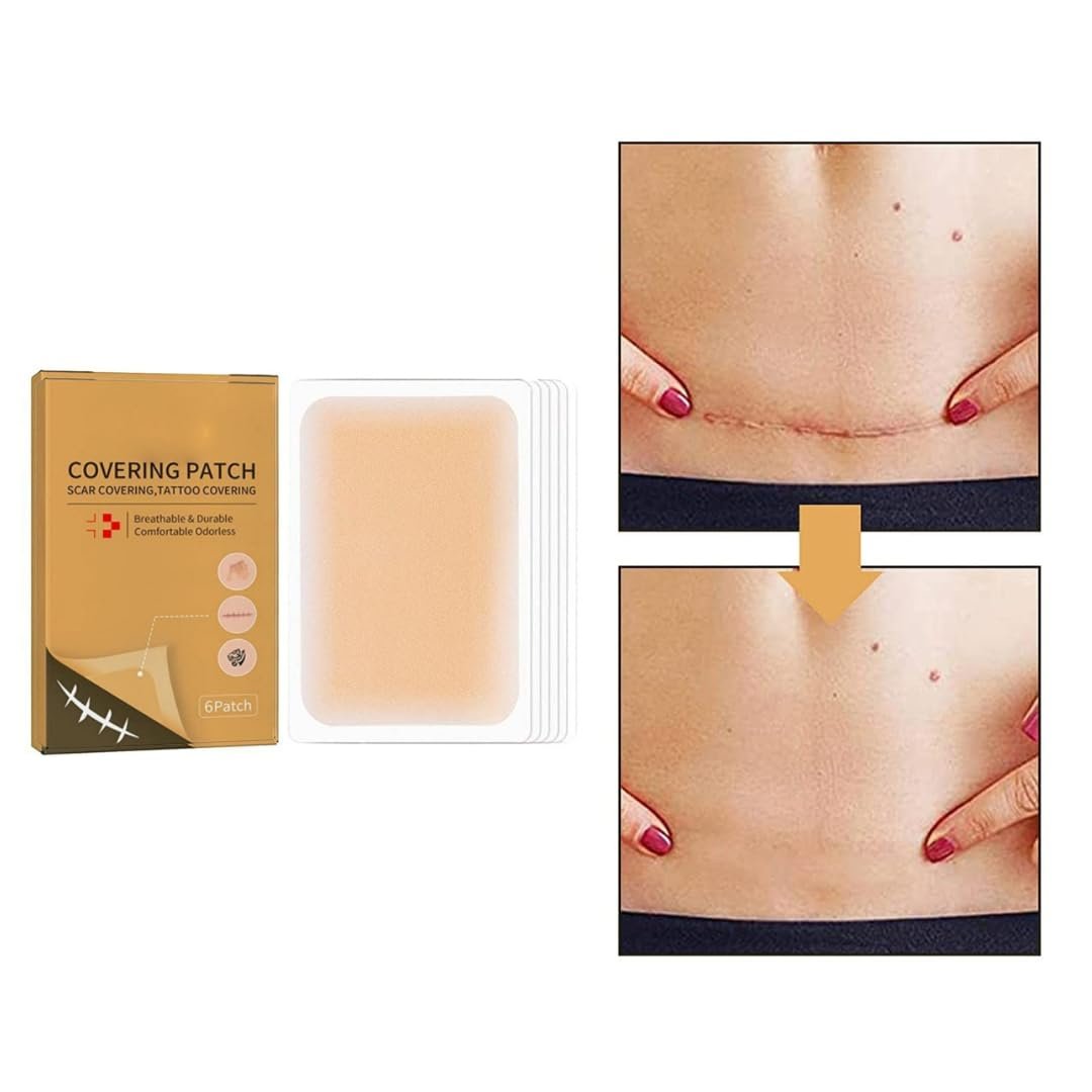 6x Tattoo Cover up Sticker Breathable Skin Concealing Tape for Body Tattoos